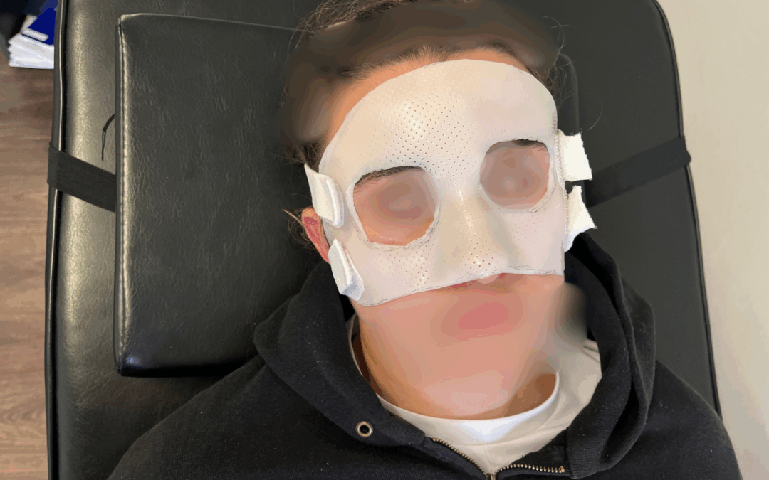Masque de protection pour fracture du nez