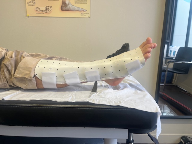 Orthèse de pied pour rupture du tendon d’Achille